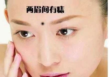 妨夫痣女|女人妨夫痣和克夫痣的化解方法解析